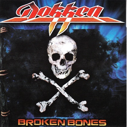 Dokken - Collection 