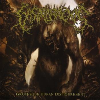 Gastrorrexis - Grotesque Human Disfigurement